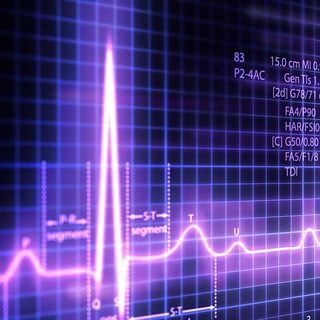 ecg dr najeeb