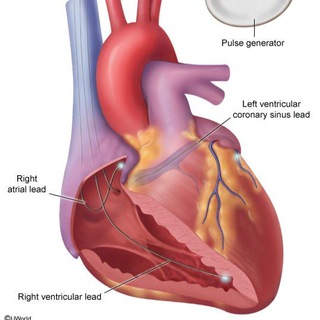 telegram channel cardiomens