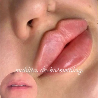 Kosmetolog Muhlisa TOSHKENT GRUPPASI??? 90 323 71 99