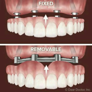 Removable & Fixed??‍⚕ - Telegram Channel