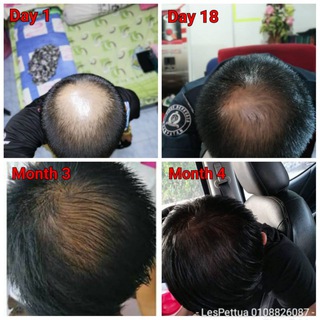 Testimoni Rambut Lebat Telegram channel